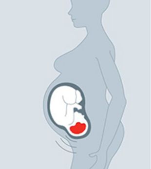 Grafik eines Fötus im Mutterleib