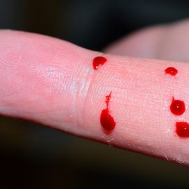 Ausgestreckter Finger mit 4 Blutstropfen darauf.